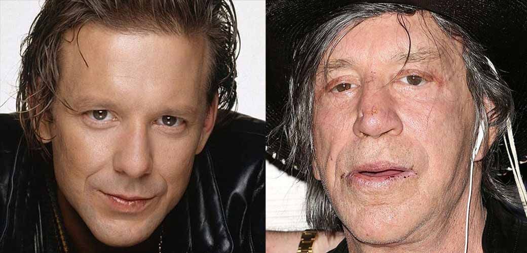 Микки Рурк до и после пластики