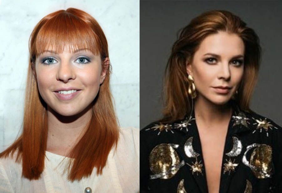 Наталья Подольская ринопластика