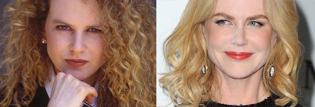 Николь Кидман пластика