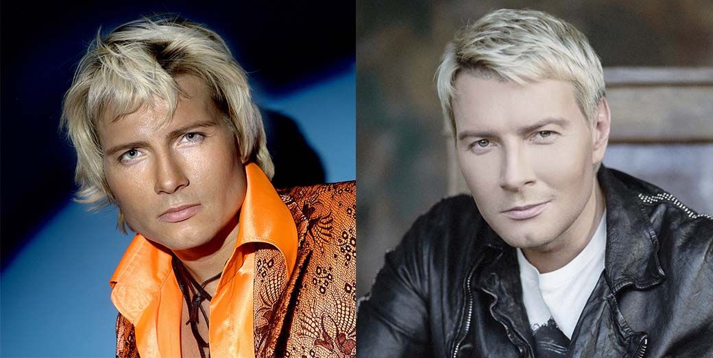 Николай Басков блефаропластика