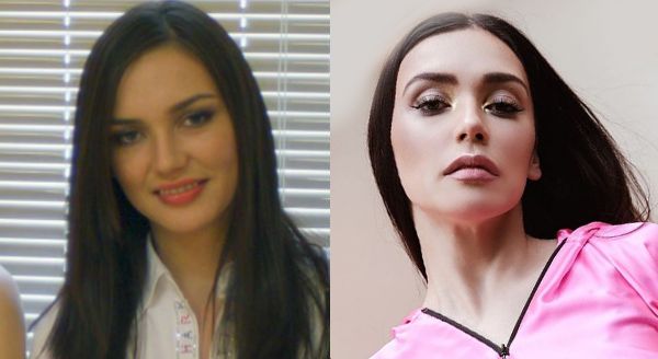 Ольга Серябкина филлеры