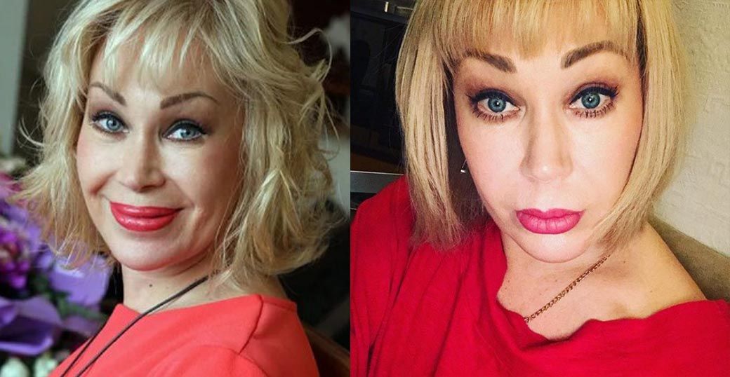 Ольга Спиркина до&nbsp;и&nbsp;после пластики