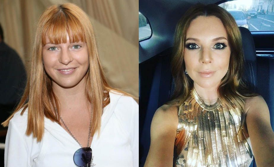 Подольская и пластика носа