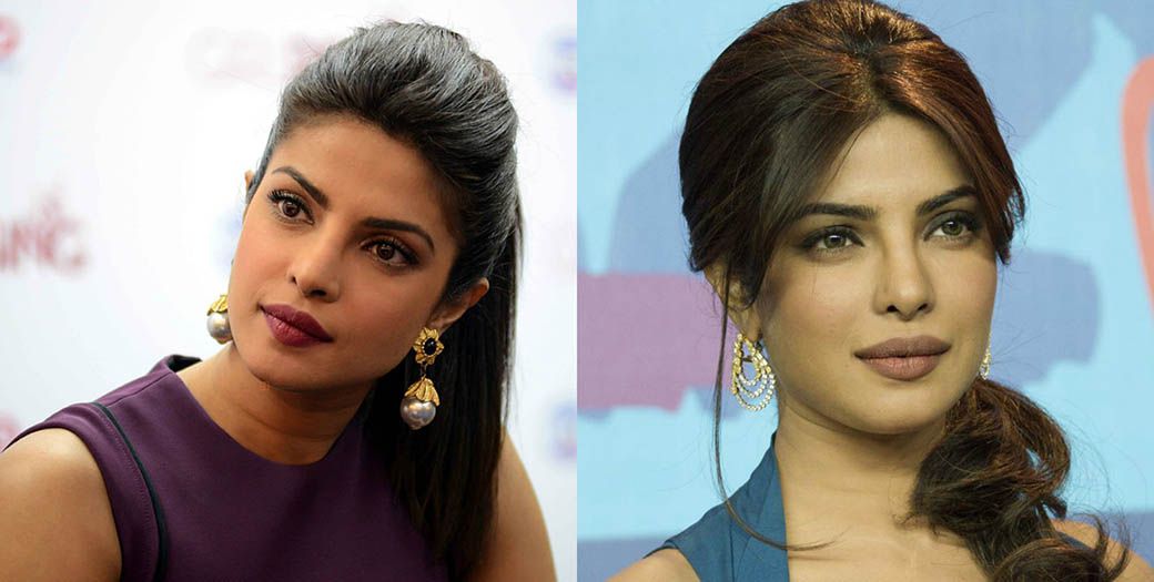 Приянка устранение складок у&nbsp;носа и&nbsp;глаз