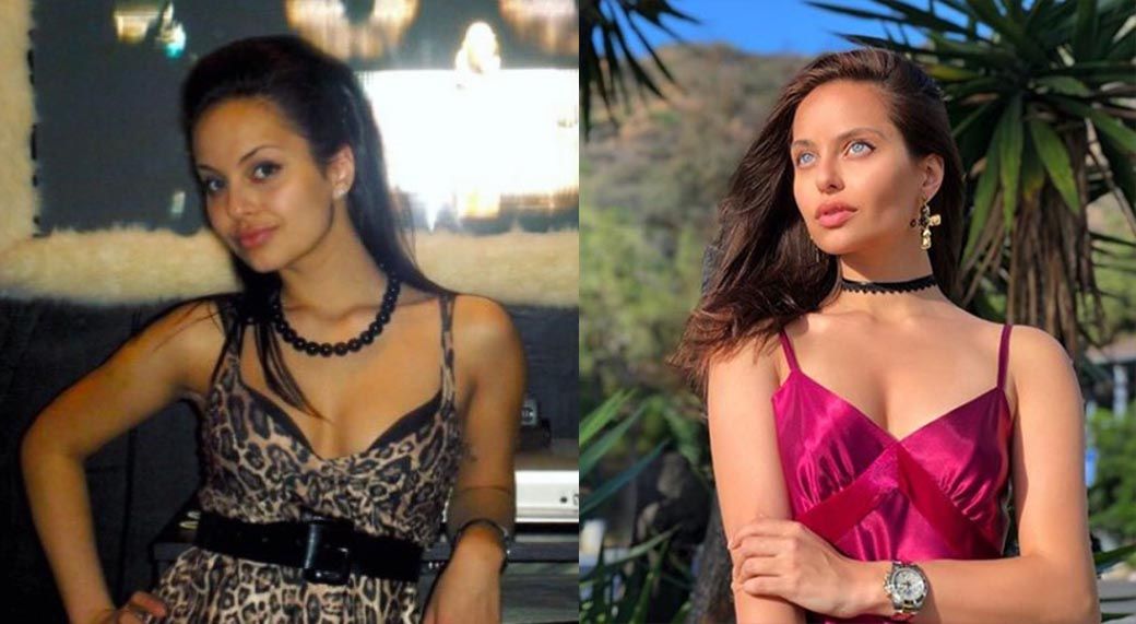 Регина Кова скулы