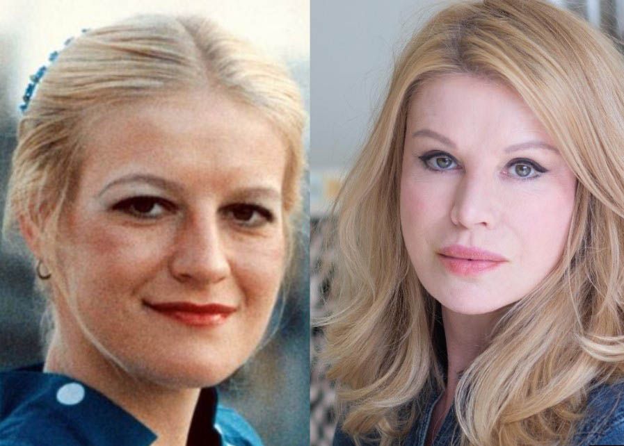 девушка-рекордсмен по&nbsp;пластике 