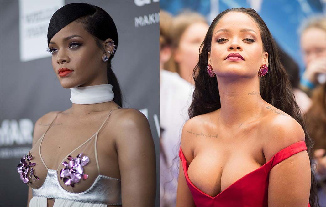 Рианна маммопластика