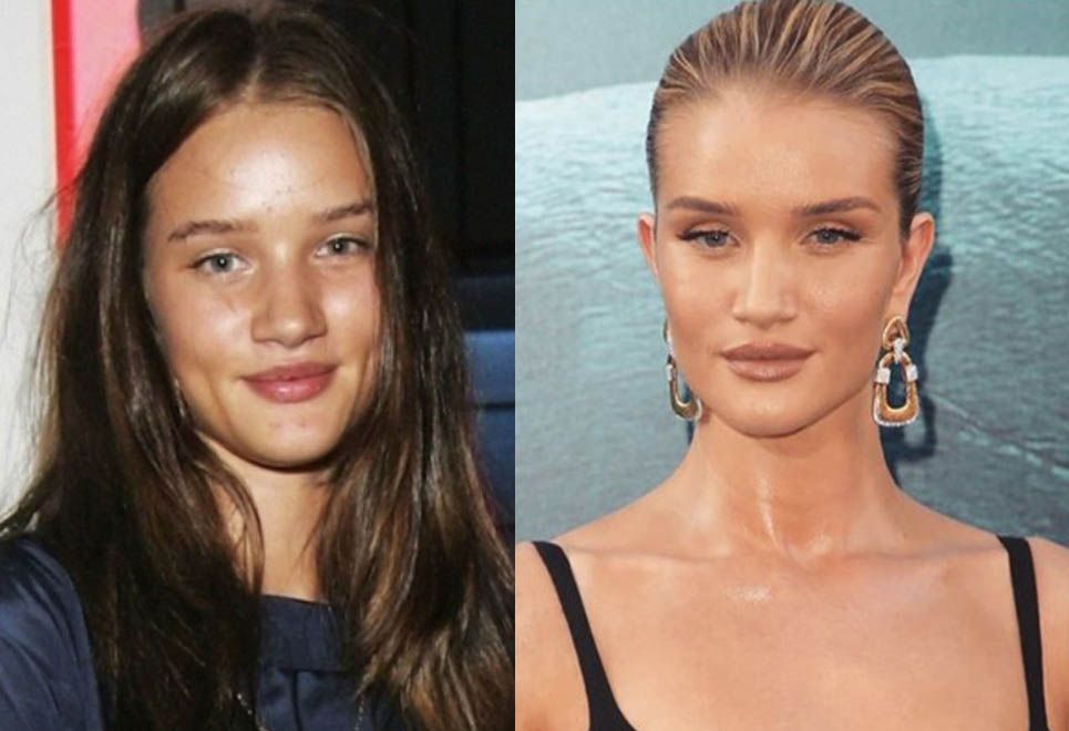 Роузи Хантингтон Уайтли ринопластика