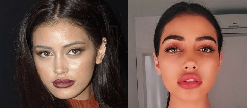 Синди Кимберли губы