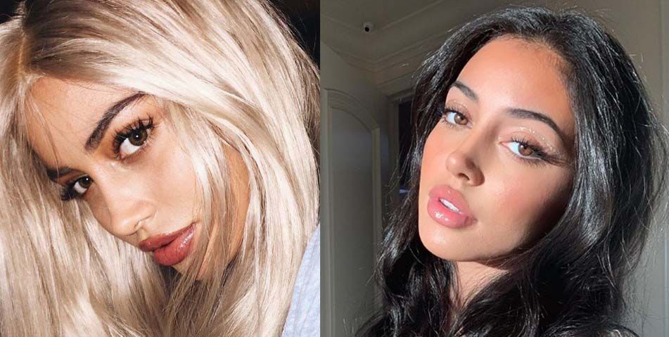 Синди Кимберли ринопластика