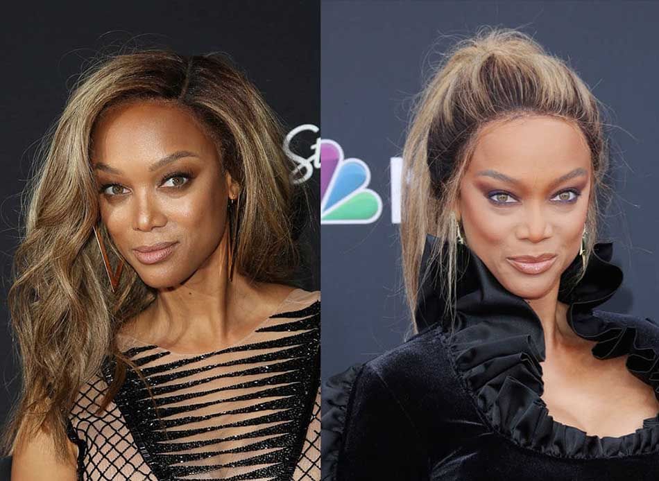 тайра до&nbsp;и&nbsp;после подтяжки лица