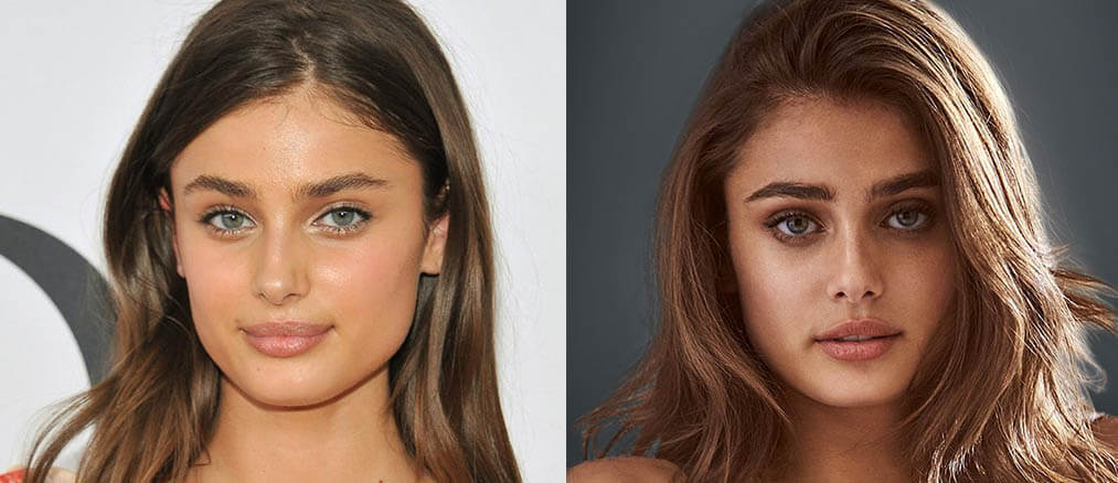 Тейлор Хилл пластика губ