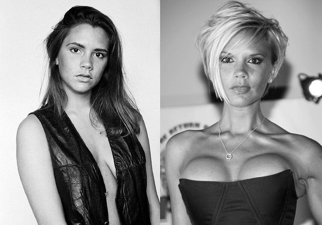 вики бекхем пластика груди