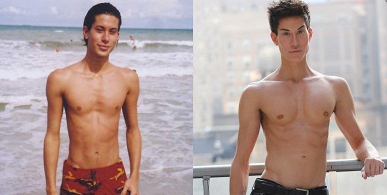 Вживленные импланты в&nbsp;тело Джастина Джедлики