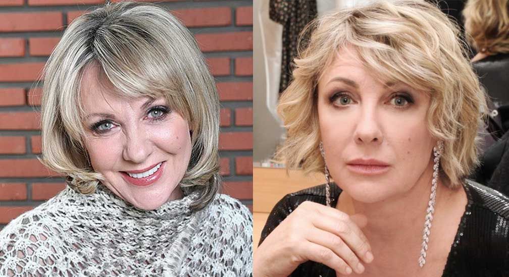 Яковлева после пластики