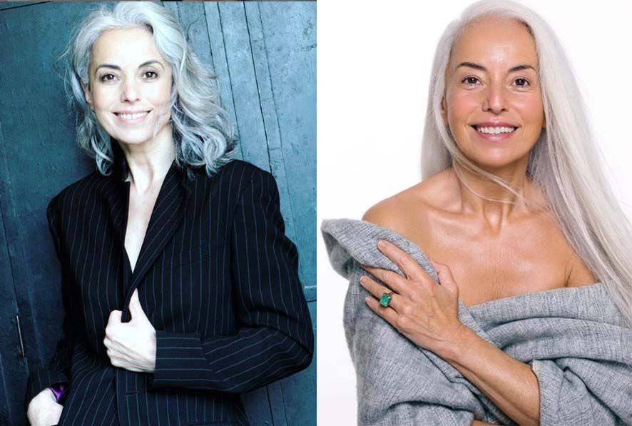 Ясмина Росси была ли пластика