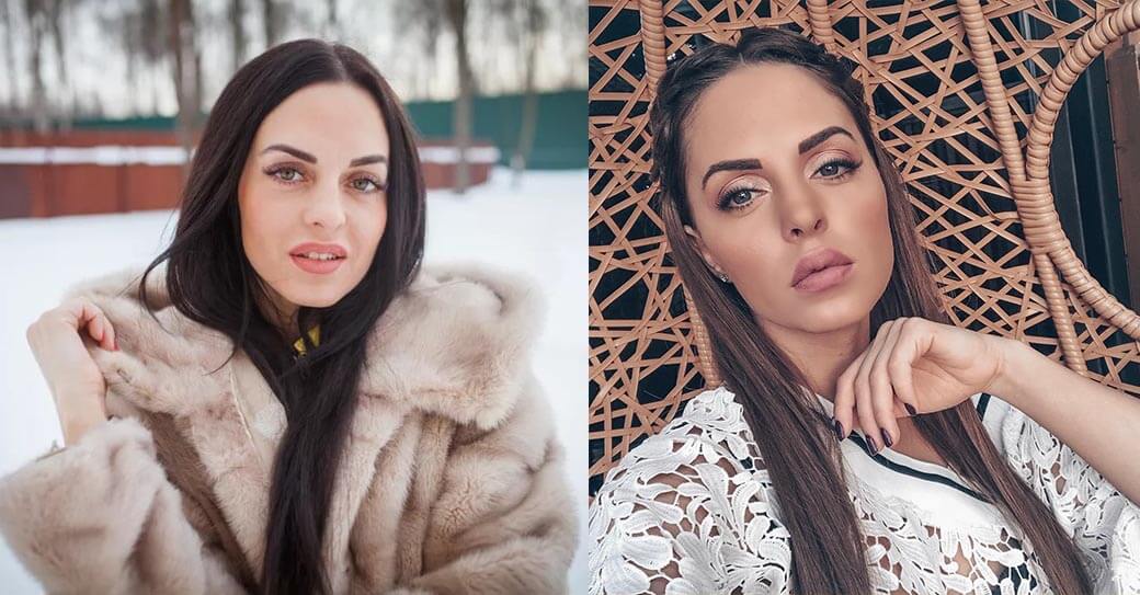 Юлия Ефременкова ринопластика