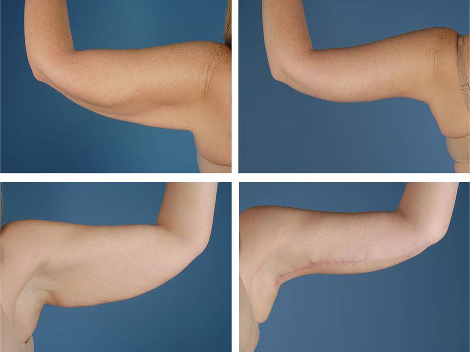 Фото до&nbsp;после