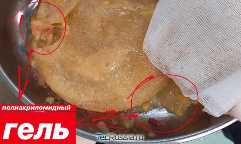 Разрыв имплантов у Кудрявцевой