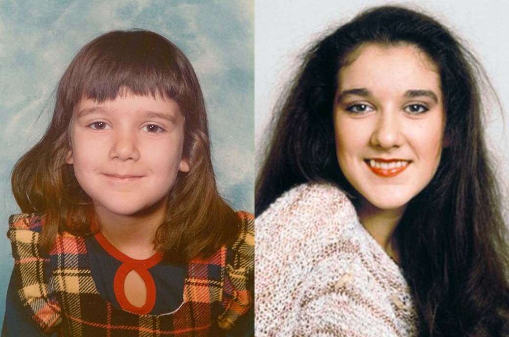 Селин Дион до пластики