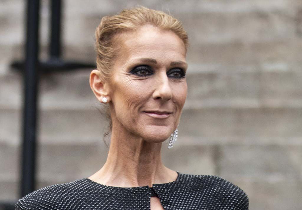 Селин Дион после пластики