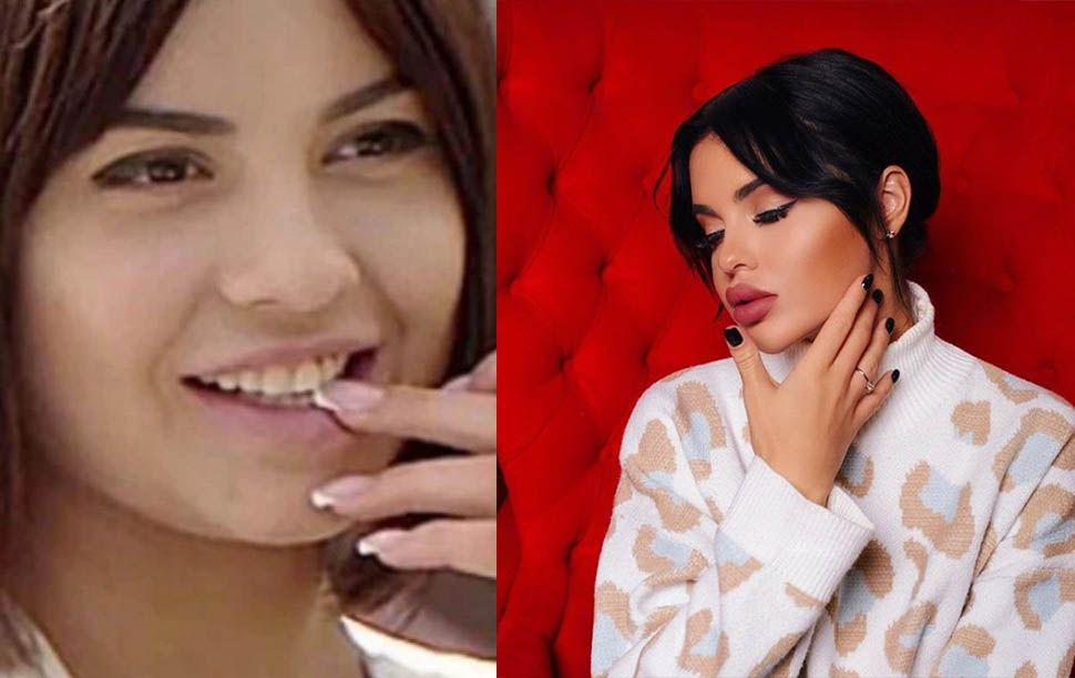 Шафеева губы