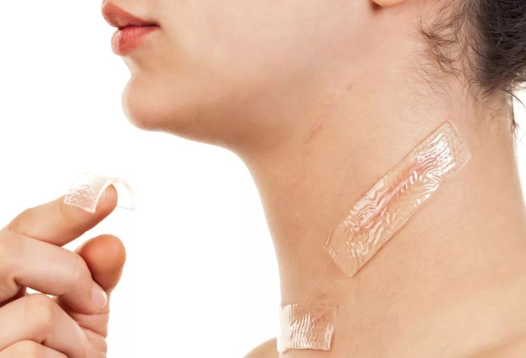 Келофибразе