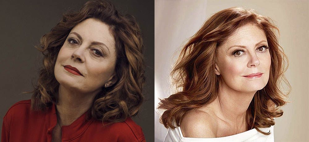 Сьюзан Сарандон подтяжка лица