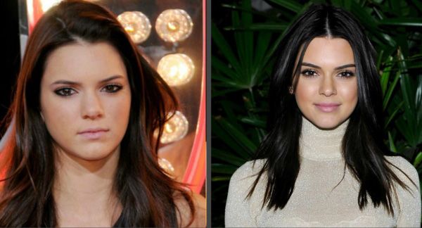 Тренды в&nbsp;пластике 2021