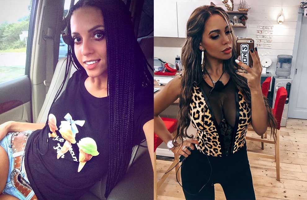 Юля Белая маммопластика